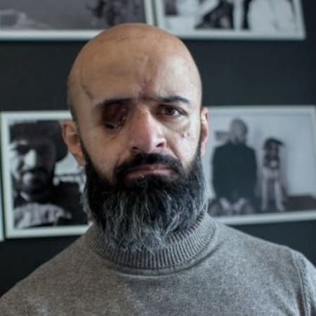 Facebook labels the photo of lawyer Mustafa-Masi Nayyem, who lost his eye in the war, as "scenes of violence and cruelty" — the ZMINA Human Rights Centre publishing the photo