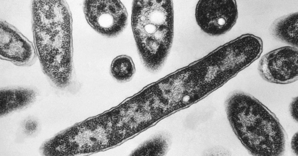 Legionnaires' disease outbreak in Poland is on the decline
