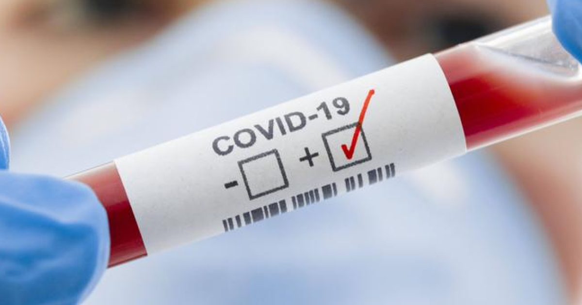 Захворюваність на COVID-19 в Україні зросла на 40% у порівнянні з попереднім тижнем